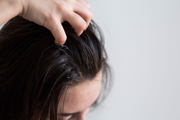A Lady Struggling With An Itchy Scalp. Photo-File