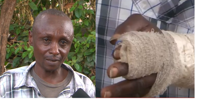 Ruiru Residents Raise Alarm Over Suspect Accused Of Biting Victims