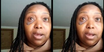 Kenyan Radio Presenter And Media Personality Ciku Muiruri Has Spoken Out After An Alleged Assault With A Crowbar At Her Family’s Property In Thika, Kiambu County.