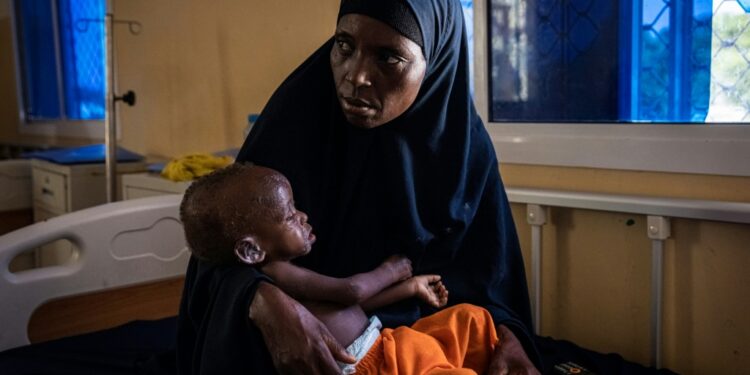 Un Says Somalia Famine Risk Worst In Half A Century Somalia