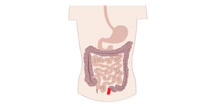 Decoding Crohn'S Disease Decoding Crohn'S Disease
Photo Courtesy