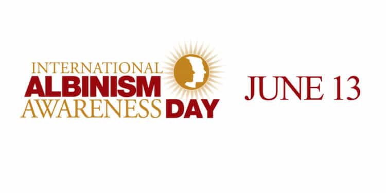 Iaad Albinism