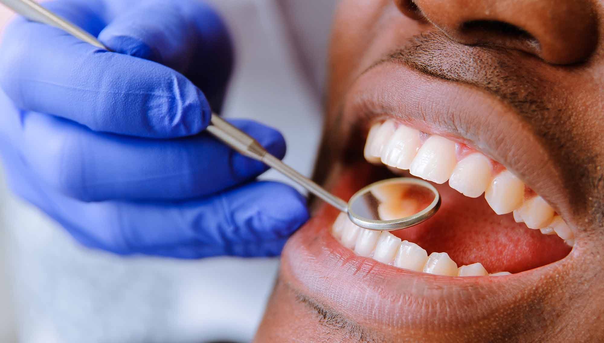 Managing Toothaches: Causes, Treatment And Prevention