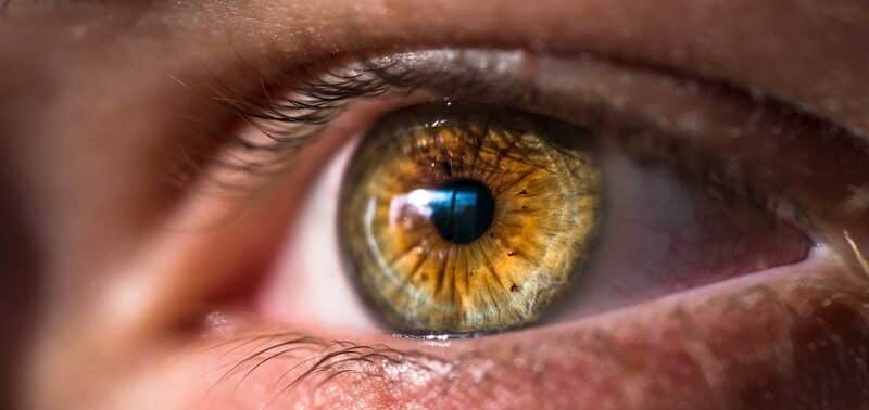 Glaucoma