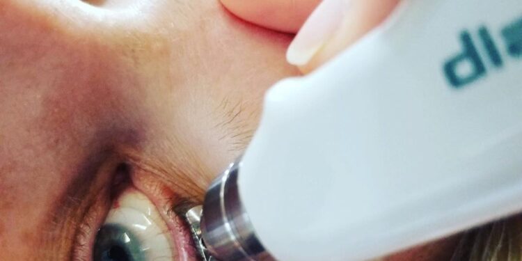 Glaucoma