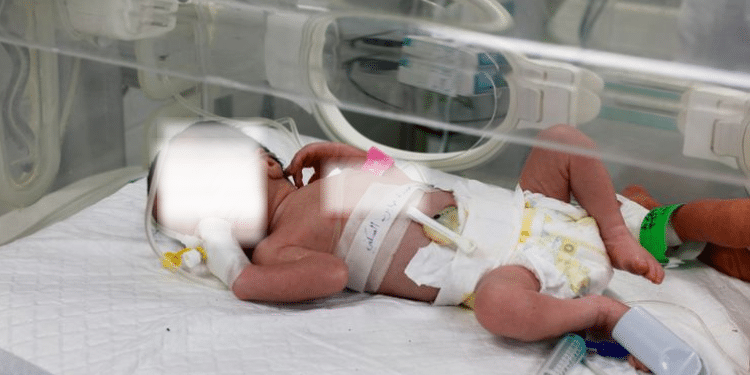 A Palestinian Baby In Gaza Is Born An Orphan In An Urgent Cesarean Section After An Israeli Strike. Photo/ Ap