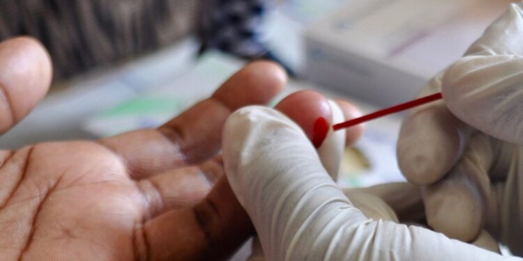 Who Lists Gay Men Among 5 Groups Of People With High Hiv Infection Rate Hiv Test In Progress. Photo/Courtesy