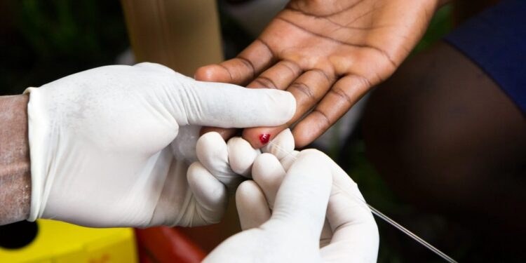 Govt Assures Kenyans On Quality Of Hiv Testing Kits