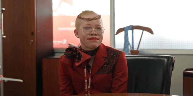 Kenya Airways Celebrates Inclusion, Recruits Special Staff Kenya Airways, Albinism