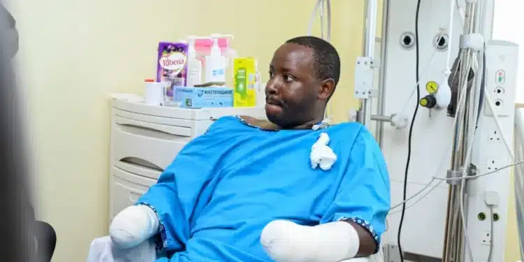 Doctors Disclose Fate Of David Maina Who Lost Hands In Protests