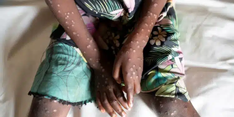 Miano-Kenyans To Desist From Handling, Consuming Bushmeat