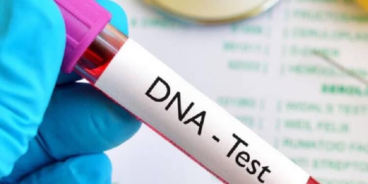 Six Tips On How To Keep Your Sugar Levels Balanced Blood Sugar Dna Test Kit.photo/File. Kemri