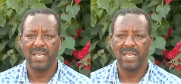 Mwangi Narrates Ordeal At The Hands Of 5 Security Guards