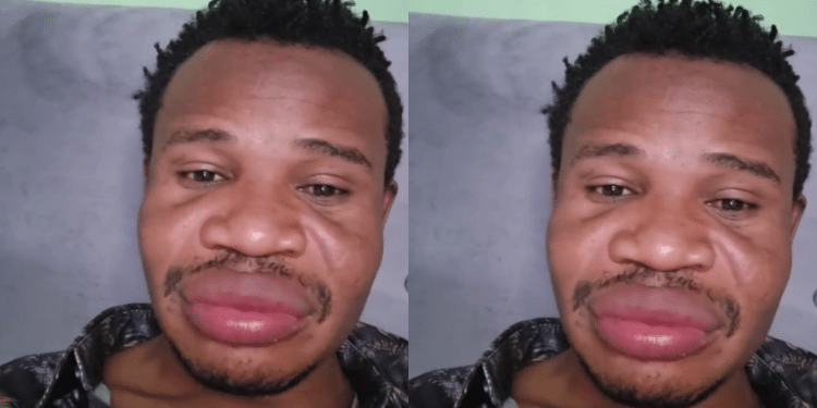 Salasya Issues Update After Undergoing Lip Surgery Mumias East Mp Peter Salasya. Photo/ Salasya Ig Screengrab