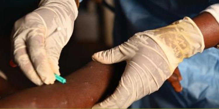 Understanding How Mpox Spreads, Symptoms, And How To Prevent A Nurse Taking A Sample From A Child Declared A Suspected Case Of Mpox Photo/Nation